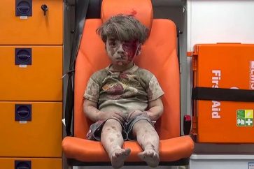 Omran Danqeesh, 5-year old Syrian boy who was injured in the current Aleppo fighting