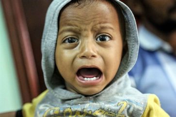 A Yemeni child, who is suspected of being infected with cholera, cries at a hospital in the Yemeni coastal city of Hodeidah on November 5, 2017 AFP