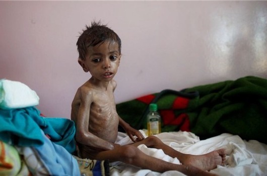 Yemen child