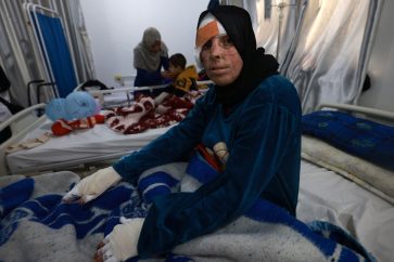 TOPSHOT - Palestinian Nisrine al-Najar receives treatment at a clinic set up by Doctors Without Border (MSF) inside the Rafah Indonesian Field Hospital in Rafah in the southern Gaza Strip, for severe injuries and burns sustained during Israeli bombardment, on March 7, 2024, on the eve of  the International Women's Day and amid ongoing battles between Israel and the Hamas movement. (Photo by MOHAMMED ABED / AFP)